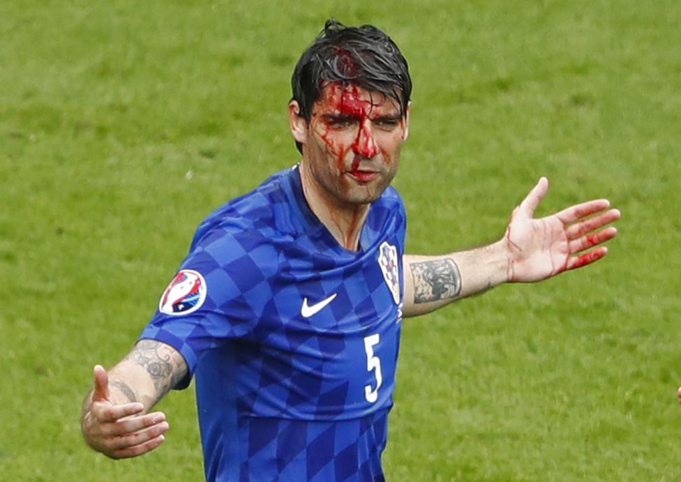 Croatia's Vedran Corluka with a head injury during his match against Turkey. REUTERS/Christian Hartmann Livepic